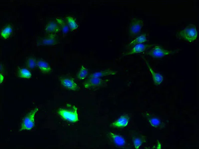 Immunocytochemistry/ Immunofluorescence - Anti-SLC25A25/APC3 antibody (AB237051)