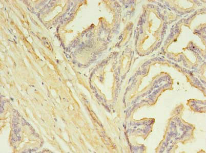 Immunohistochemistry (Formalin/PFA-fixed paraffin-embedded sections) - Anti-SLC25A25/APC3 antibody (AB237051)