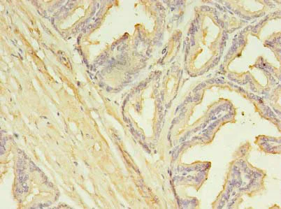 Immunohistochemistry (Formalin/PFA-fixed paraffin-embedded sections) - Anti-SLC25A25/APC3 antibody (AB237051)