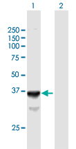 Western blot - Anti-SLC25A3/PHC antibody (AB67121)