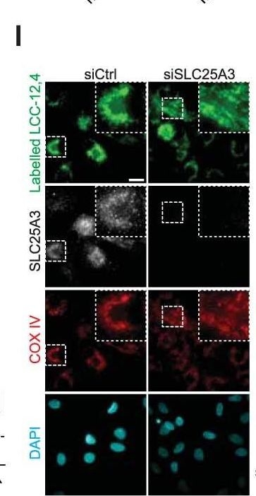 Immunocytochemistry/ Immunofluorescence - Anti-SLC25A3/PHC antibody (AB89117)