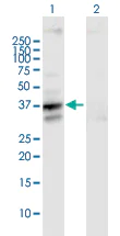 Western blot - Anti-SLC25A3/PHC antibody (AB89117)