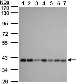 Western blot - Anti-SLC25A33 antibody (AB97820)