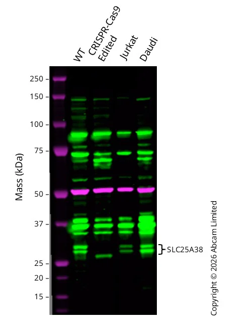 Western blot - Anti-SLC25A38 antibody [EPBHMR1] (AB133614)