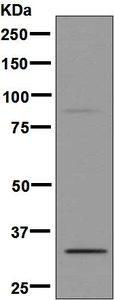 Western blot - Anti-SLC25A38 antibody [EPBHMR1] (AB133614)