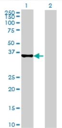 Western blot - Anti-SLC25A40 antibody (AB69075)