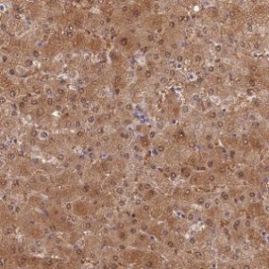 Immunohistochemistry (Formalin/PFA-fixed paraffin-embedded sections) - Anti-SLC25A41 antibody (AB126372)