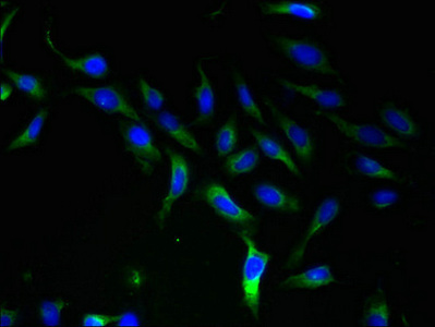 Immunocytochemistry/ Immunofluorescence - Anti-SLC25A46/TB1 antibody (AB237760), expandable thumbnail