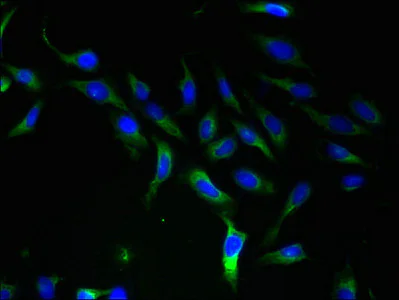 Immunocytochemistry/ Immunofluorescence - Anti-SLC25A46/TB1 antibody (AB237760)