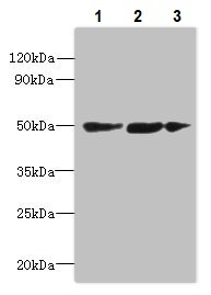 Western blot - Anti-SLC25A46/TB1 antibody (AB237760), expandable thumbnail