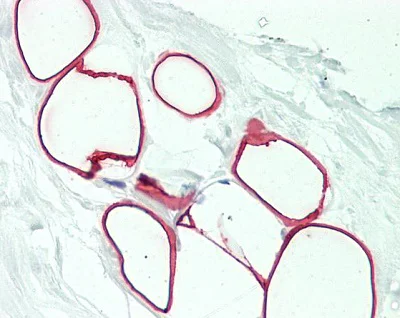 Immunohistochemistry (Formalin/PFA-fixed paraffin-embedded sections) - Anti-SLC25A6 antibody (AB230545)