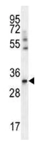 Western blot - Anti-SLC25A6 antibody (AB230545)