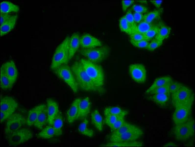 Immunocytochemistry/ Immunofluorescence - Anti-SLC26A2/DTD antibody (AB238591)