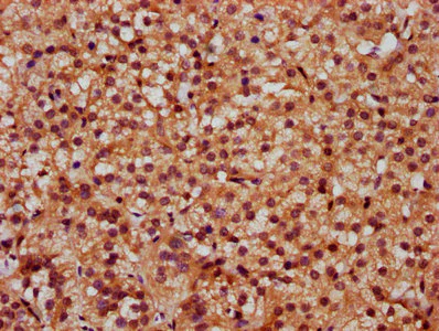 Immunohistochemistry (Formalin/PFA-fixed paraffin-embedded sections) - Anti-SLC26A2/DTD antibody (AB238591)