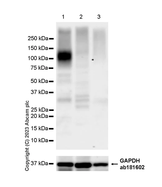 Western blot - Anti-SLC26A2/DTD antibody [EPR27119-17] (AB308625)