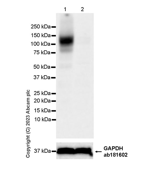 Western blot - Anti-SLC26A2/DTD antibody [EPR27119-17] - BSA and Azide free (AB308626), expandable thumbnail