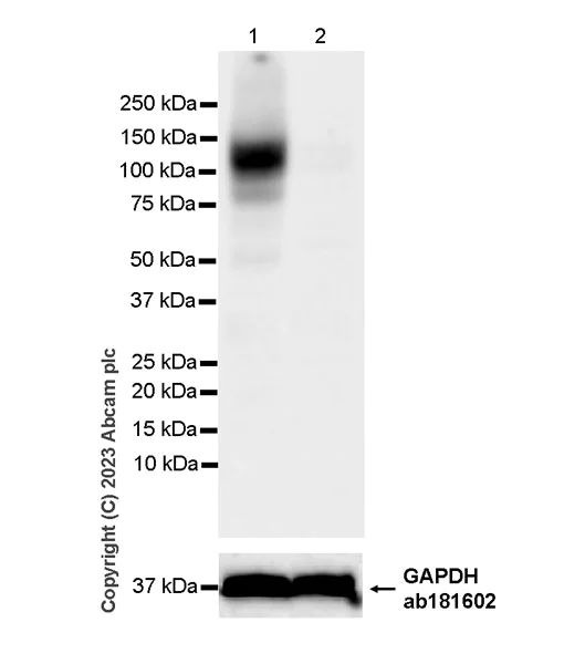 Western blot - Anti-SLC26A2/DTD antibody [EPR27119-17] - BSA and Azide free (AB308626)