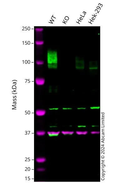 Western blot - Anti-SLC26A2/DTD antibody [EPR27119-17] - BSA and Azide free (AB308626)