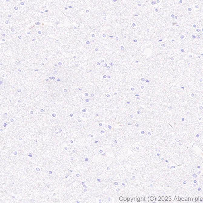Immunohistochemistry (Formalin/PFA-fixed paraffin-embedded sections) - Anti-SLC26A2/DTD antibody [EPR27119-34] - BSA and Azide free (AB308628)