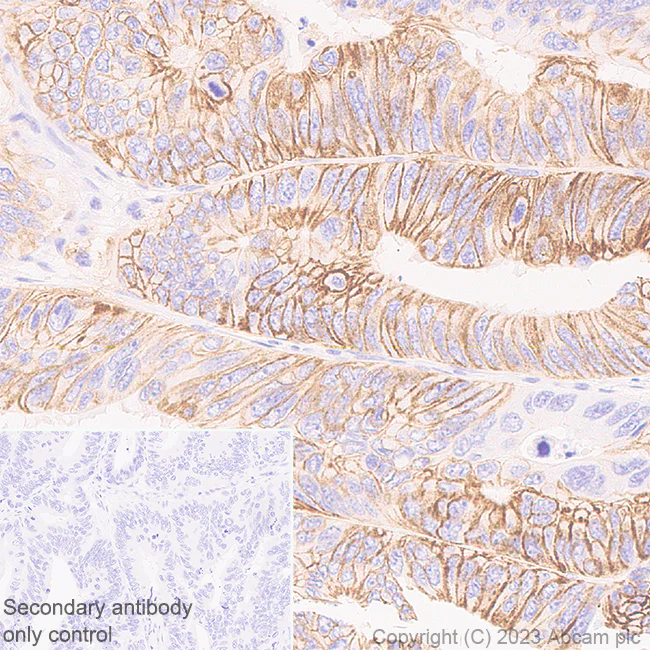 Immunohistochemistry (Formalin/PFA-fixed paraffin-embedded sections) - Anti-SLC26A2/DTD antibody [EPR27119-34] - BSA and Azide free (AB308628)
