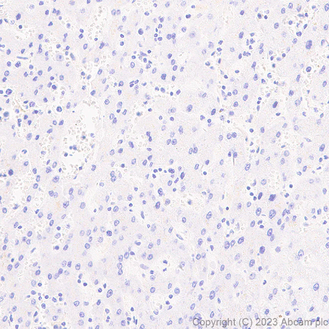 Immunohistochemistry (Formalin/PFA-fixed paraffin-embedded sections) - Anti-SLC26A2/DTD antibody [EPR27119-34] - BSA and Azide free (AB308628)