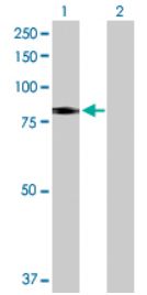 Western blot - Anti-SLC26A6/Pat1 antibody (AB172684)