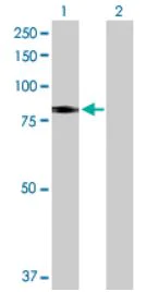 Western blot - Anti-SLC26A6/Pat1 antibody (AB172684)