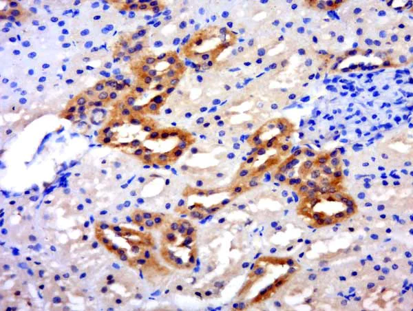 Immunohistochemistry (Formalin/PFA-fixed paraffin-embedded sections) - Anti-SLC26A6/Pat1 antibody (AB217269)