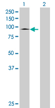 Western blot - Anti-SLC26A6/Pat1 antibody (AB67959), expandable thumbnail