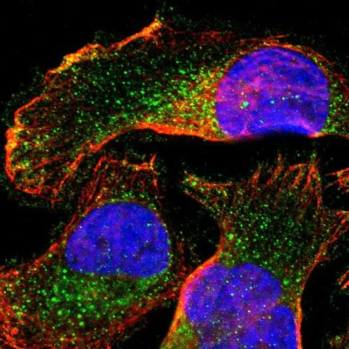 Immunocytochemistry/ Immunofluorescence - Anti-SLC27A4 / FATP4 antibody (AB244298)