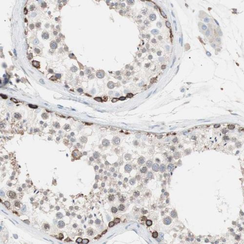 Immunohistochemistry (Formalin/PFA-fixed paraffin-embedded sections) - Anti-SLC27A4 / FATP4 antibody (AB244298)