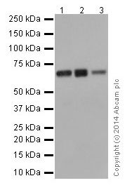 Western blot - Anti-SLC27A4 / FATP4 antibody [EPR17319-26] (AB200353)