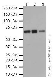 Western blot - Anti-SLC27A4 / FATP4 antibody [EPR17319-26] (AB200353)