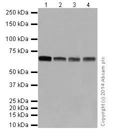Western blot - Anti-SLC27A4 / FATP4 antibody [EPR17319-26] (AB200353)