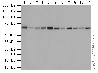 Western blot - Anti-SLC27A4 / FATP4 antibody [EPR17319-26] (AB200353)