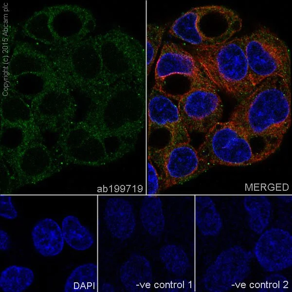 Immunocytochemistry/ Immunofluorescence - Anti-SLC27A4 / FATP4 antibody [EPR17319] - C-terminal (AB199719)