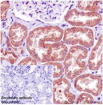 Immunohistochemistry (Formalin/PFA-fixed paraffin-embedded sections) - Anti-SLC27A4 / FATP4 antibody [EPR17319] - Low endotoxin, Azide free (AB221783)
