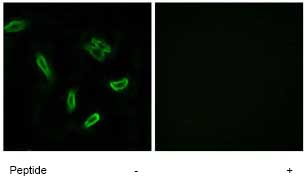 Immunocytochemistry/ Immunofluorescence - Anti-SLC27A5/BAL antibody (AB74869)
