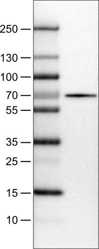 Western blot - Anti-SLC27A5/BAL antibody [CL0213] (AB154140)