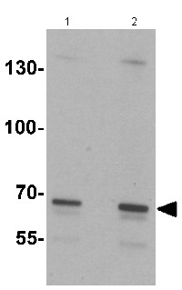 Western blot - Anti-SLC27A6/FATP6 antibody (AB167099)