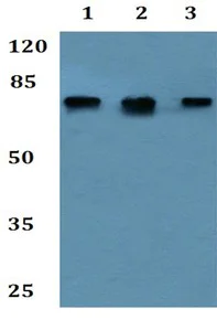 Western blot - Anti-SLC28A1 antibody (AB192438)