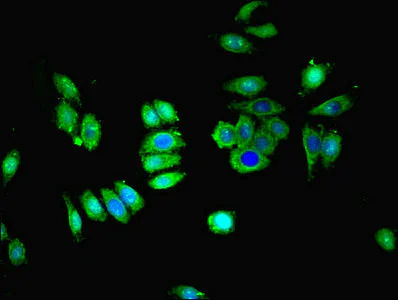 Immunocytochemistry/ Immunofluorescence - Anti-SLC28A1 antibody (AB238865)