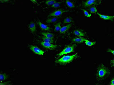 Immunocytochemistry/ Immunofluorescence - Anti-SLC28A1 antibody (AB238865)