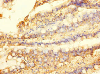 Immunohistochemistry (Formalin/PFA-fixed paraffin-embedded sections) - Anti-SLC28A1 antibody (AB238865)