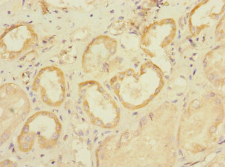 Immunohistochemistry (Formalin/PFA-fixed paraffin-embedded sections) - Anti-SLC28A1 antibody (AB238865)