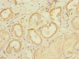Immunohistochemistry (Formalin/PFA-fixed paraffin-embedded sections) - Anti-SLC28A1 antibody (AB238865)