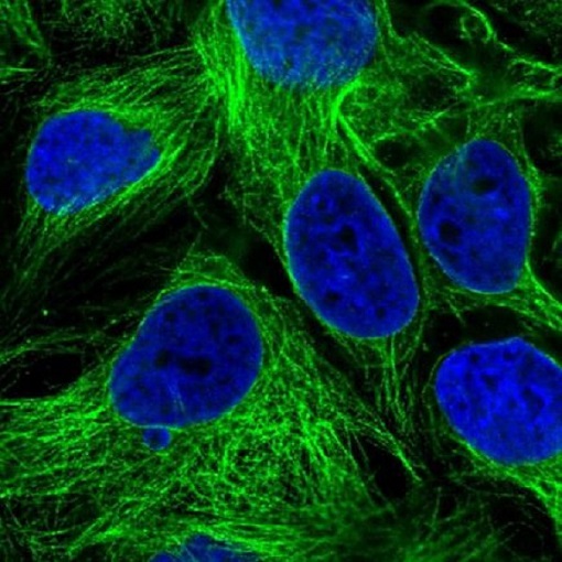 Immunocytochemistry/ Immunofluorescence - Anti-SLC29A4/PMAT antibody (AB220706)