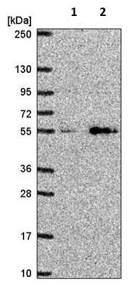 Western blot - Anti-SLC29A4/PMAT antibody (AB220706)