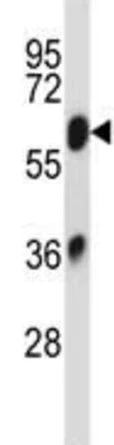 Western blot - Anti-SLC2A13 antibody (AB190163)
