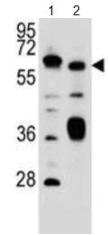 Western blot - Anti-SLC2A13 antibody (AB190163)